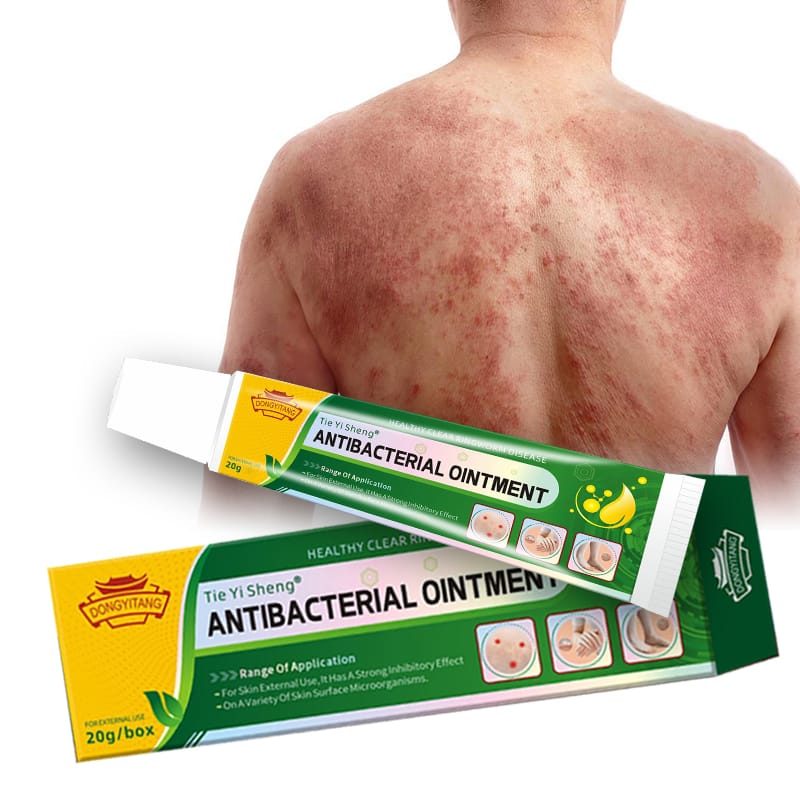 Antibacterial Ointment 30g – Skin Protection & Antibacterial Topical Cream
