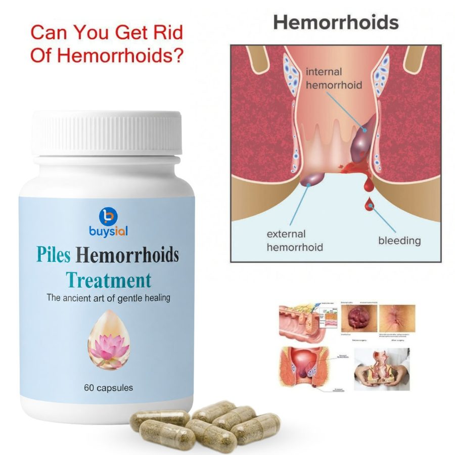 BuySial Piles & Hemorrhoids Treatment Capsules – 60 Capsules